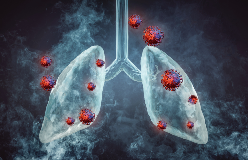 Can Lung Cancer Be Cured?