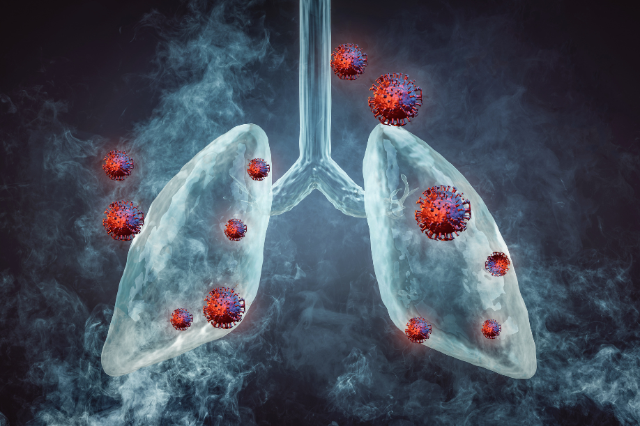 Can Lung Cancer Be Cured?
